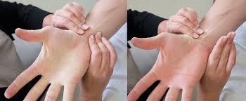 Image result for Allen Test