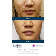 Designer Sunglasses Burberry Geometric Frame Sunglasses Burberry Men's Icon  Stripe Square Acetate Sunglasses Neiman