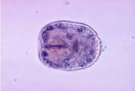 Possono riscontrarsi sintomi come dolore e colore giallastro dell'ittero (pelle). Parassiti Dell Intestino Echinococcosi Infestazioni Da Echinococco O Echinococcus Granulosus Infezione Sintomi Diagnosi Terapia Cura Prevenzione Gastroenterologo Endoscopista Dott Prof Antonio Iannetti