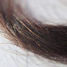 Well, that is true, if you use a common shampoo long enough and often enough. Hair Testing For Drug Use Gathers Steam But Worries Of Bias Remain
