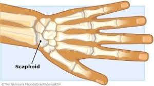 Image result for Scaphoid Bone