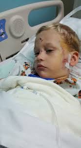 Father: 4-year-old injured in pit bull attack