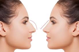 أسعار عمليات التجميل في مصر.. أرقام ستفاجئك