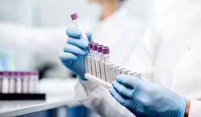 Image result for Screening Test