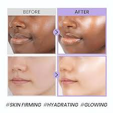 coxir BLACK SNAIL COLLAGEN CREAM l Snail Mucin, Collagen, Black Rice,  Peptide l Moisturizing, Firming, Skin Barrier l Korean Skin Care,  Moisturizer [50ml/1.69 fl.oz] : Amazon.in: Beauty