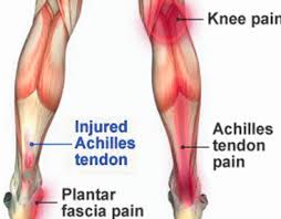 Injecting around the tendon area can help pain symptoms however, repeat. What Is Inner Thigh Tendonitis Graphic Online
