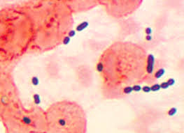 Sputum Wikipedia