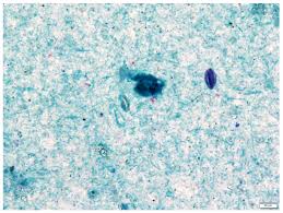Gram Stain Image Hi-Res Stock Photography And Images - Alamy