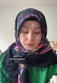 Understanding Epilepsy and Cerebral Palsy Support