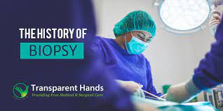 A needle biopsy is a procedure to obtain a sample of cells from your body for laboratory testing. The History Of Biopsy Medical Procedures And Surgeries