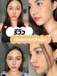 ทำแล้วหน้าเด็ก: รีวิวหัตถการโบท็อกซ์และฟิลเลอร์