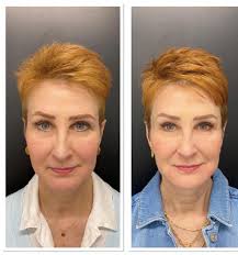 Beauty & Grace Aesthetics