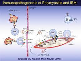 Image result for Polymyositis