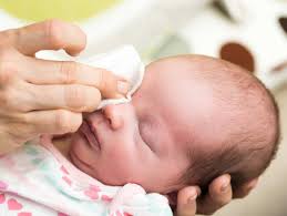 Is it okay to get them removed by laser. Common Mistakes That Parents Make While Cleaning Their Newborn The Times Of India