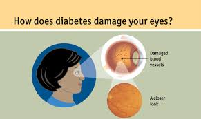 Staten island, ny & hazlet, nj pediatric ophthalmologists, pediatric eyecare of staten island specializes in comprehensive medical and surgical care for all your child's visual needs in the staten island & hazlet area. South Shore Eyecare Associates 718 979 2020 Home