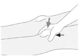 Image result for Ballottable Patella Sign