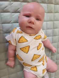 Is spitting up and hiccups a sign of overfeeding?