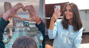 Popálená youtuberka týnuš třešničková slavila narozeniny! Prvykrat Od Nehody Ukazala Tvar Tynus Tresnickova Rukavom Skryva Jej Popalenu Cast Skandal Magazin