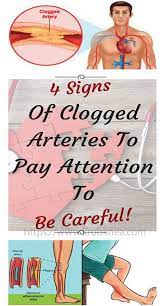 Your risk is highest if your father or a brother was diagnosed with heart disease before age 55 or if your mother or a sister developed it before age 65. 4 Signs Of Clogged Arteries To Pay Attention To Clogged Arteries Arteries Natural Health