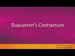Check spelling or type a new query. Pronunciation Of The Word S Dupuytren S Contracture Youtube