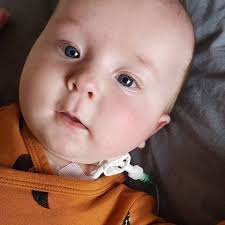 Fundraiser by Kat Phillips : Maverick's Medical Fund