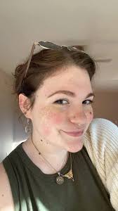 Weight loss after gastric sleeve surgery