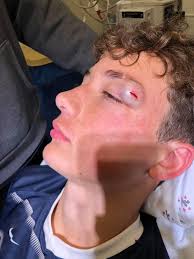 Operation Ward 57 Happy 3 Year Alive Day to Seth Pack! While out