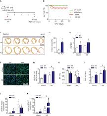 MicroRNA-216a is essential for cardiac angiogenesis: Molecular Therapy