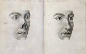 The presentation of plastic surgery visual data from 1816 to 1916: The  evolution of reproducible results