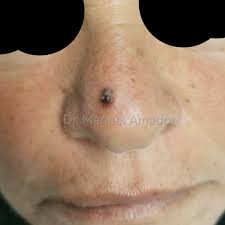 Dr. Manuel E. Amador R. (@dr.manuel_amador) • Instagram photos and videos