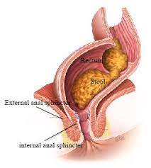 Fecal Incontinence Your Pelvic Floor