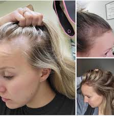 This is Samantha! And…..This is her story! ❤️ “This is a 12 week  difference! It leaves me speechless & with tears in my eyes a The amount of  gratitude I have for