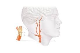 They are the carotid arteries, and they carry blood to the brain. Carotid Endarterectomy Nhs