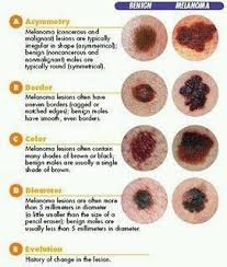 Pin On Melanoma Skin Cancer