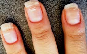 Maybe you would like to learn more about one of these? 8 Weird Things That Can Happen To Your Fingernails And What They Say About Your Health Women S Health