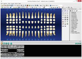 Dexis And Dentrix Seamless Integration Redefined Dentrix