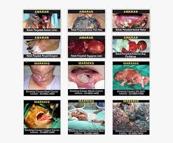 Before using, read the health and safety warnings in the vr headset instruction manual. 12 Pictorial Health Warning Images Cigarettes Pictures In Malaysia Hd Png Download Kindpng