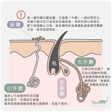 國外網站 國內網站 農委會所屬機關網站 本局業務網站 食安五環專區 國民法官專區. æ­¢æ±—å¤§å°æ±º åŒ–å­¸æ­¢æ±—åŠ'vs å¤©ç„¶æ­¢æ±—è† Beautysaur Organics
