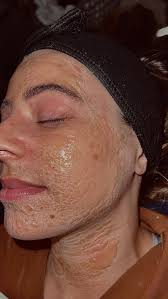 Skintini by Lily Salinas