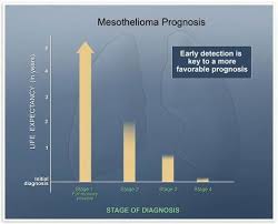 We did not find results for: Pin On Mesothelioma Hub