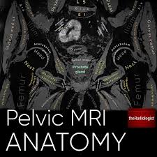 The gonadal arteries arise directly from the aorta and carry blood to the gonads (testicles or ovaries). Theradiologist On Twitter Annotated Male Pelvic Mri Anatomy