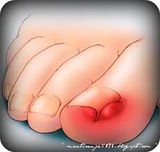 Dan aku diberi konseling oleh ibu endar, guru agama. Kuku Cekam Cagu Ruzanaibs Com