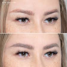 How to remove eyebrow tattoos safely & inexpensively. Microblading Permanent Makeup Laser Removal Eye Design Studio