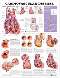 cardiovascular disease anatomical chart