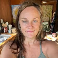 I'm post explant and confused about what/how I should be using my arms. Any  suggestions?