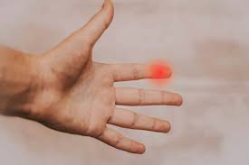 Image result for phlegmon on face)