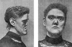 We did not find results for: Pin On Odd Human Body