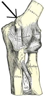 This study was performed to investigate any role of the shape of medial humeral epicondyle in the etiology of osteoarthritis in the. Medial Epicondyle Of The Humerus Wikipedia