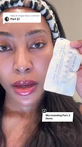 Replying to @Angela May PART 2: Microneedling Demo and Technique! 🫶 #fyp  #licensedesthetician #howtomicroneedle #howtogetridofhyperpigmentation  #clearskin