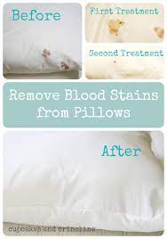 Hydrogen peroxide is perhaps best known as a blood stain remover all by itself (as discussed below), but it works well to remove many other types of stains but while peroxide works well in combination with dish soap for many stains, there are other stains where just the peroxide alone is most effective. Pin On Cleaning Tips